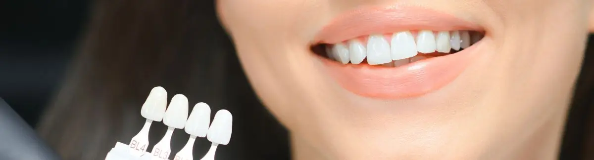 Atención en odontología para blanqueamiento dental en Villavicencio