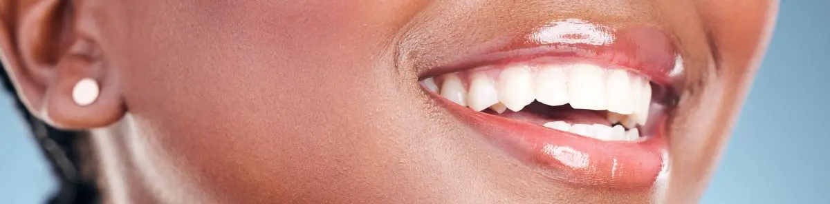 Especialista en blanqueamiento dental en Barzal Villavicencio
