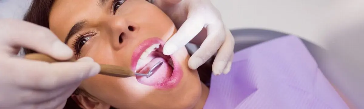 Experto en blanqueamiento dental en Barzal Villavicencio