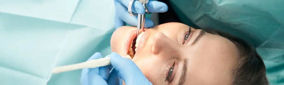 Expertos en odontología para exodoncia en Villavicencio