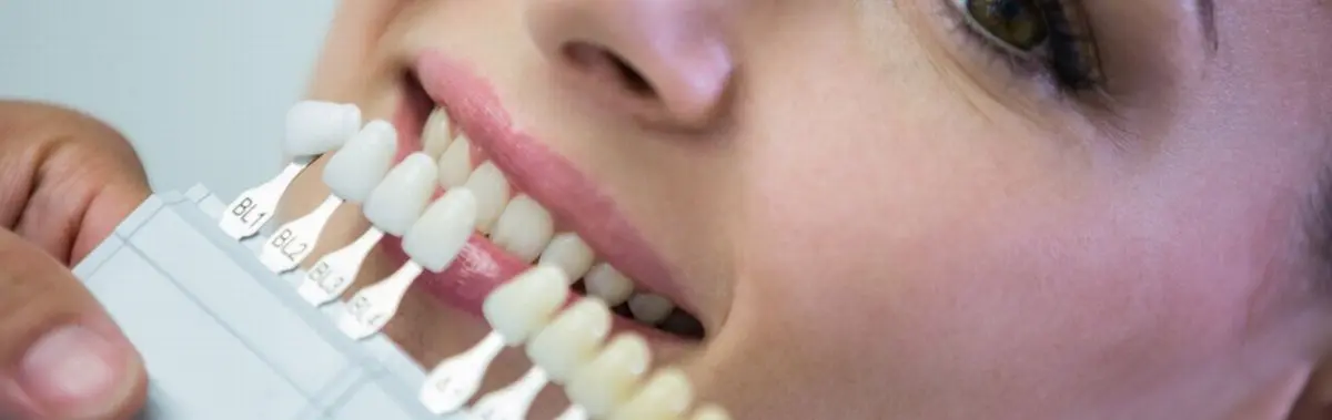 Mejores carillas dentales estéticas Barzal Villavicencio