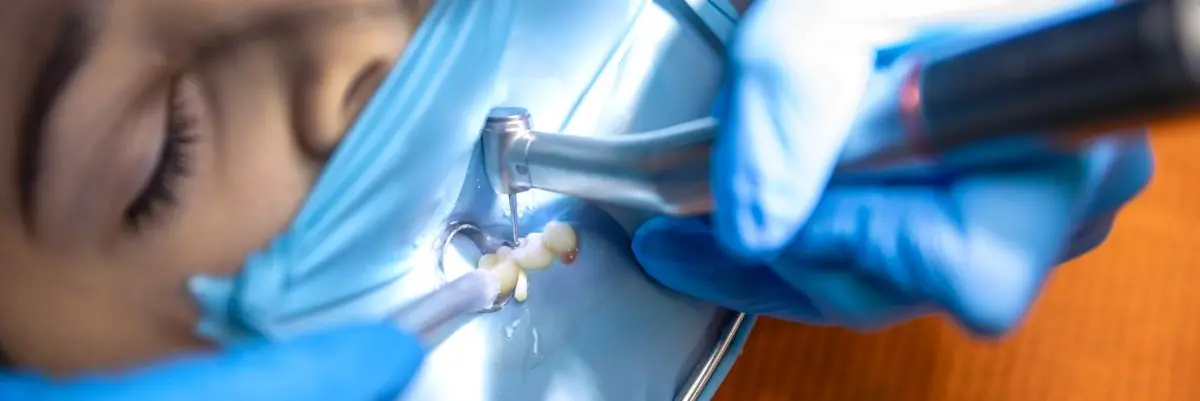 Odontología estética para exodoncia en Villavicencio