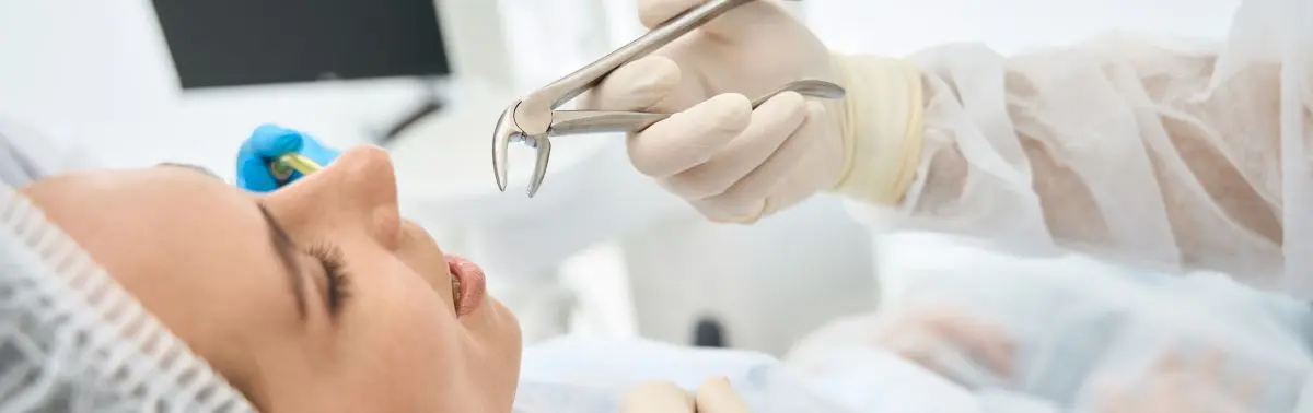 Precios de odontología para exodoncia en Villavicencio Precios de odontología para exodoncia en Villavicencio