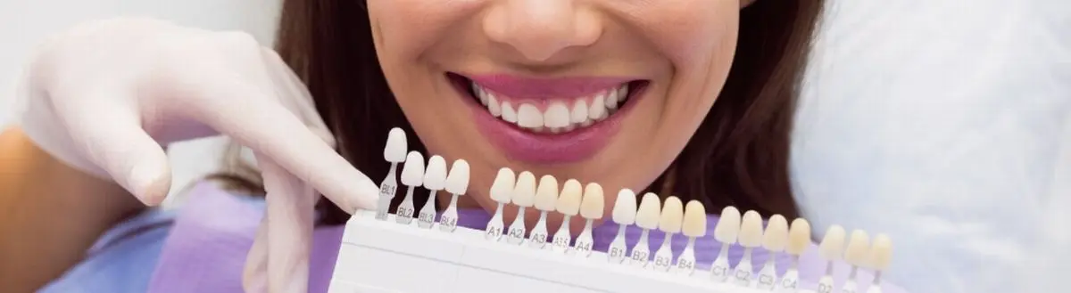 Servicio de odontología para blanqueamiento dental en Villavicencio