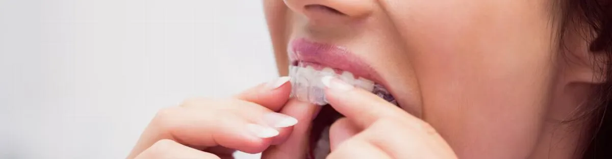 Tratamiento para bruxismo con placas dentales en Villavicencio