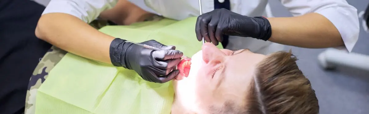 Tratamientos de odontología para exodoncia en Villavicencio