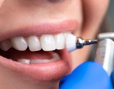 Fluorización Dental